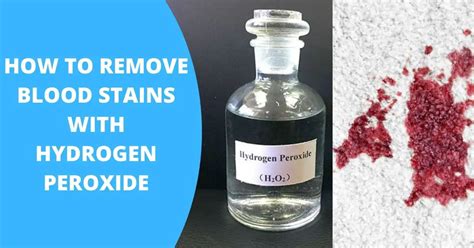 peroxide remove blood